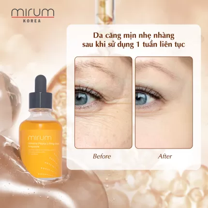 Tinh Chất Tái Tạo, Dưỡng Ẩm, Chống Nhăn & Tăng Sự Đàn Hồi Cho Da Mirum 50ml - Mirum Wrinkle Pepta Lifting Shot Ampoule